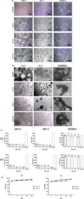 Antimetastatic and antitumor activities of oncolytic NDV AMHA1 in a 3D culture model of breast cancer